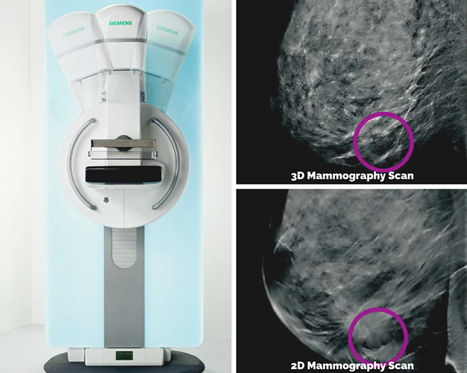 CCH 3D Mammography in Gillette Wyoming