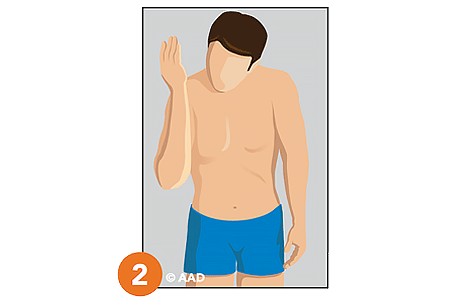 Illustration of a person examining forearm for signs of skin cancer
